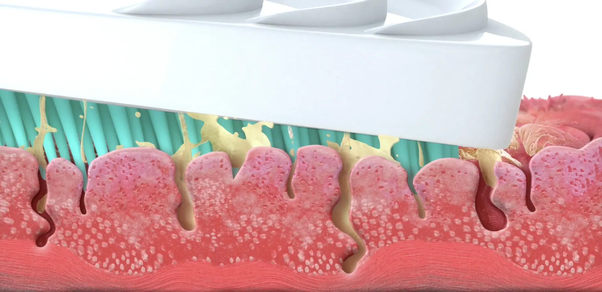  best tongue cleaners